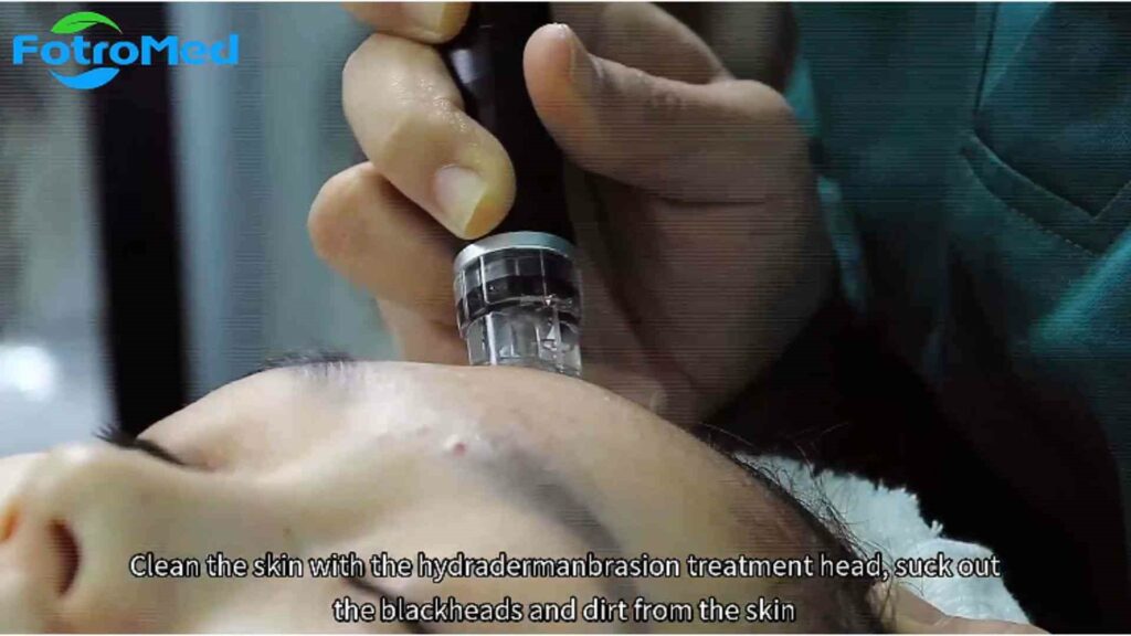 効果的なスキンケアのためのOxygen Reviveマシンの使用方法 (3)