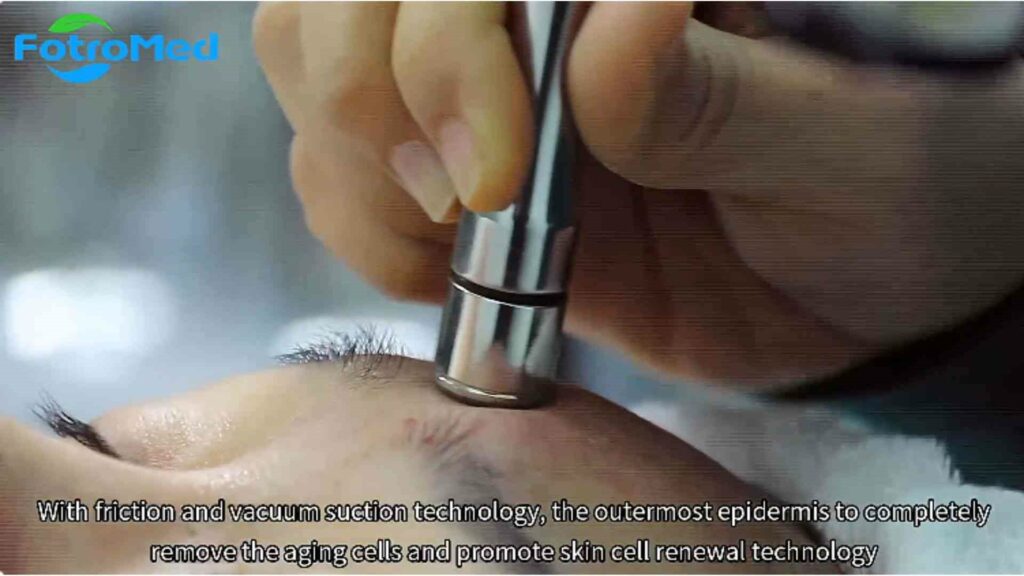 効果的なスキンケアのためのOxygen Reviveマシンの使用方法 (4)