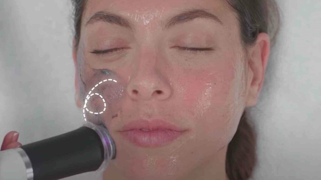 Oxygeneoデバイスの使用方法（2）