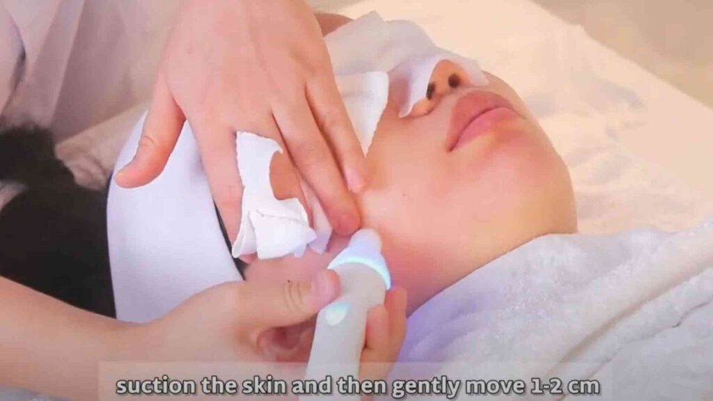 Smart Ice Blue 7-in-1 フェイシャルマシンの使用ステップバイステップガイド (4)