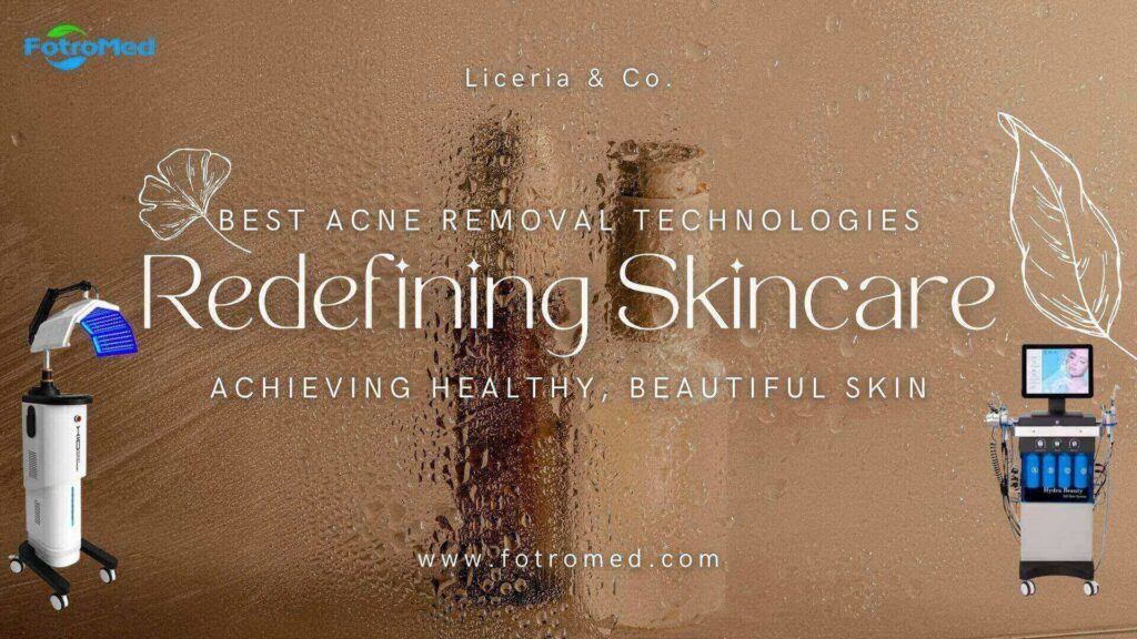 スキンケアを再定義する最高のにきび除去技術