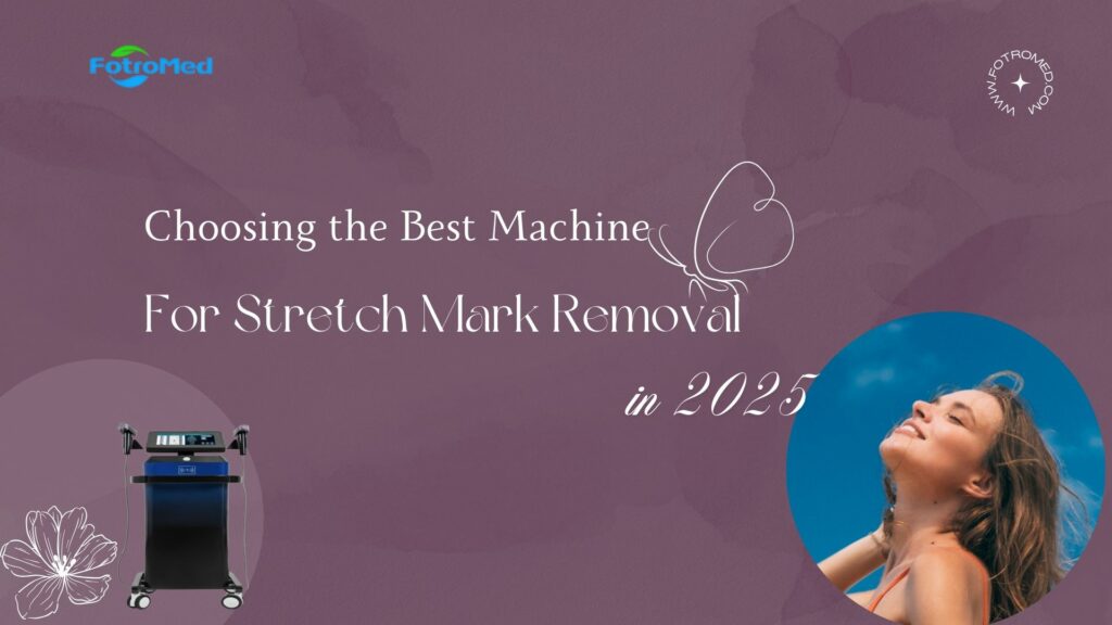 ストレッチマーク除去に最適なマシンを選択します 2025